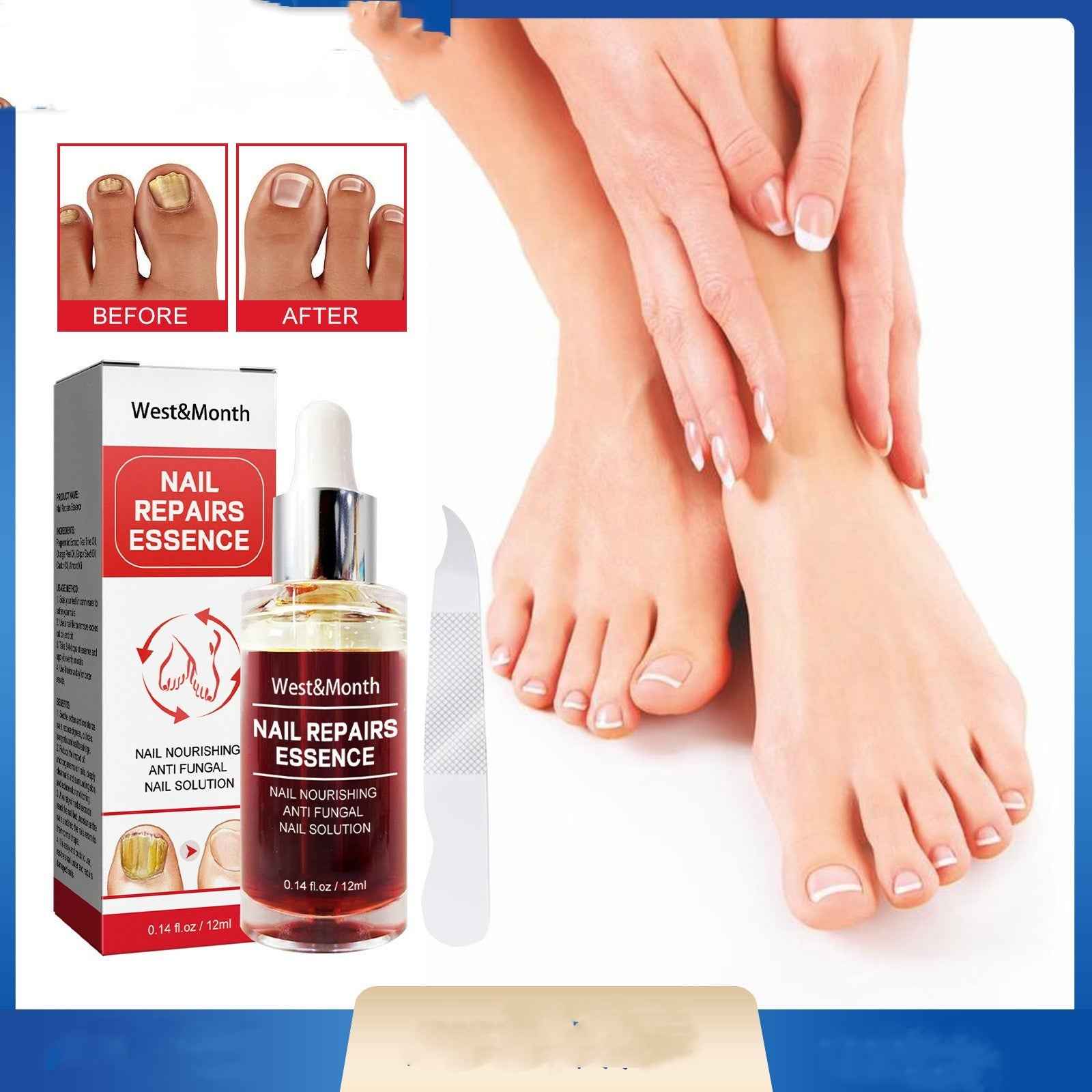 Nail Repair Essence Hand And Foot Care Solution