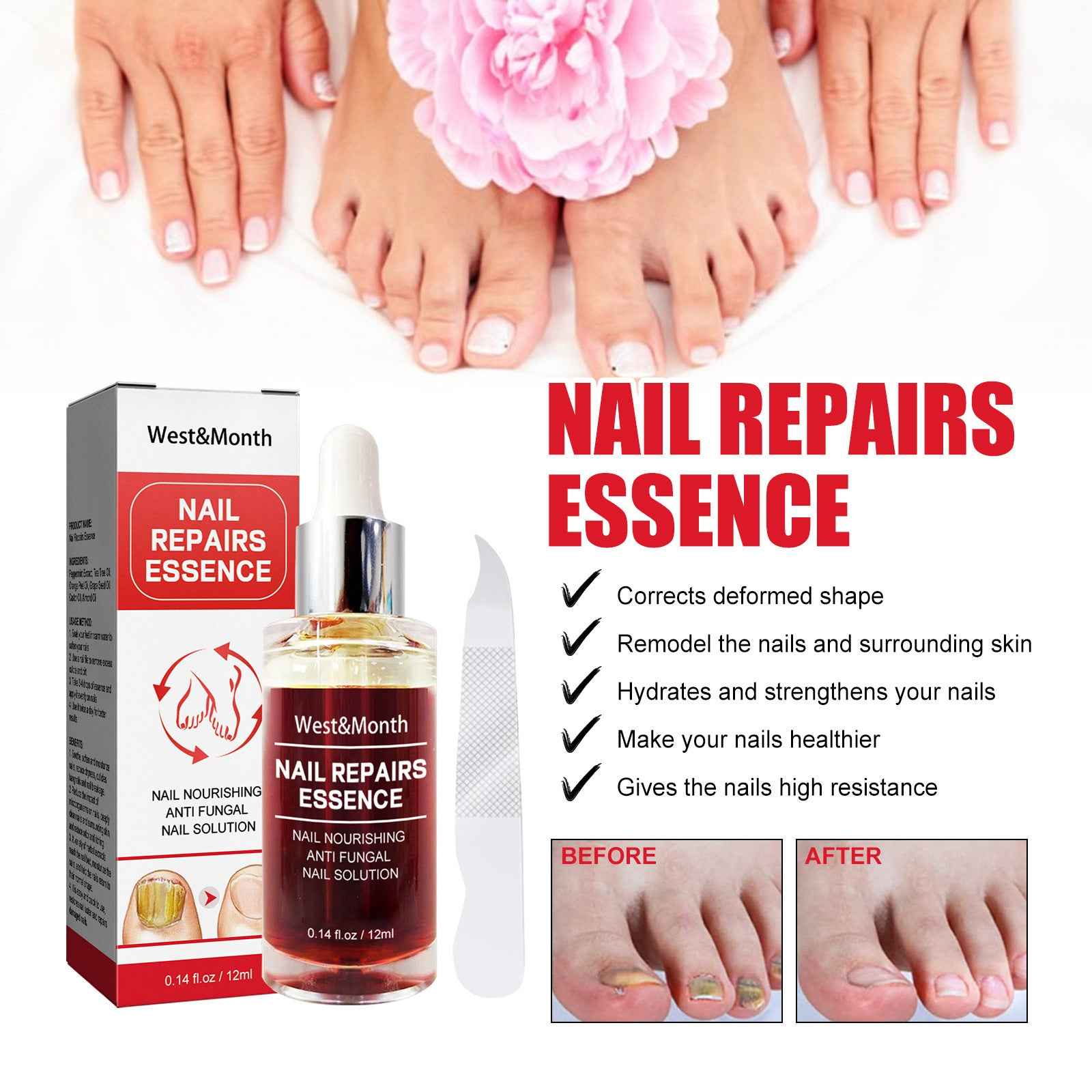 Nail Repair Essence Hand And Foot Care Solution